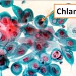 Chlamydia фото