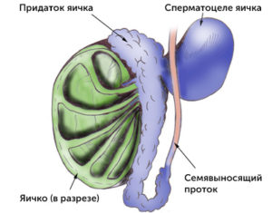 Диференціювати кісту яєчка необхідно з такими захворюваннями, як сперматоцелє